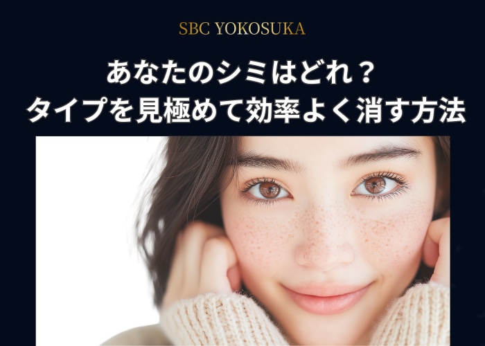 【肝斑にも対応】横須賀のシミ治療は湘南美容クリニック横須賀中央院へ